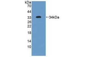 Detection of Recombinant FLNa, Human using Polyclonal Antibody to Filamin A Alpha (FLNa) (Filamin A antibody  (AA 2-274))