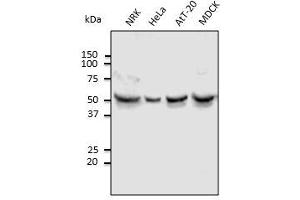 Anti-Tubulin alpha4A Ab at 1,000 dilution, lysates at 100 µg per Iane, Rabbit polyclonal to goat IgG (HRP) at 1/10,000 dilution. (TUBA4A antibody  (N-Term))