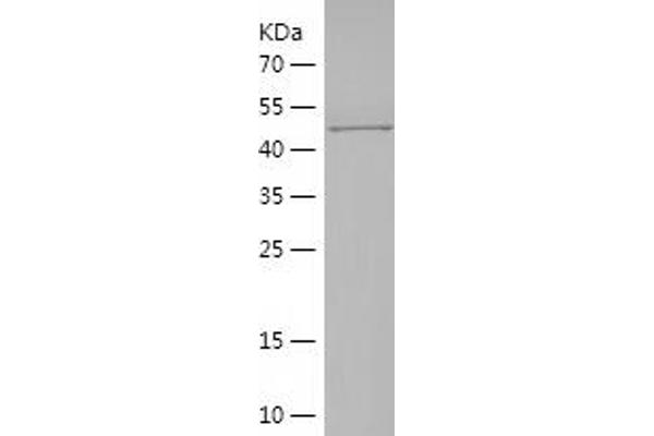 MYH2 Protein (AA 22-304) (His-IF2DI Tag)