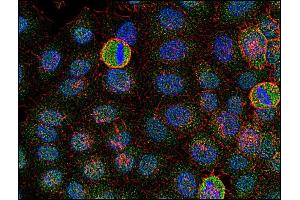 Immunofluorescence staining of Fyn in human HeLa cell line using anti-Fyn (FYN antibody  (AA 7-176))