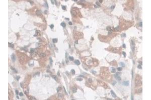 Immunohistochemistry (IHC) image for anti-Spectrin Repeat Containing, Nuclear Envelope 2 (SYNE2) (AA 6-296) antibody (ABIN7436189)
