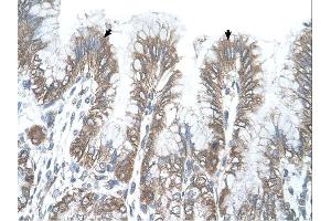 RSRC2 antibody was used for immunohistochemistry at a concentration of 4-8 ug/ml. (RSRC2 antibody  (C-Term))