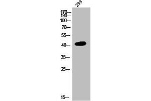 Western Blot analysis of 293 cells using NMBR Polyclonal Antibody (NMBR antibody  (Internal Region))