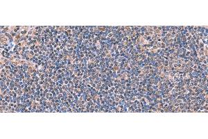 Immunohistochemistry of paraffin-embedded Human tonsil tissue using PEPD Polyclonal Antibody at dilution of 1:70(x200) (PEPD antibody)