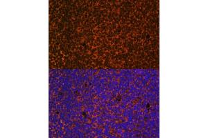 Immunofluorescence analysis of mouse embryos cells using PTCH1 antibody (ABIN1682368, ABIN1682367, ABIN3015342, ABIN3015343 and ABIN6213997) at dilution of 1:100. (Patched 1 antibody  (AA 1214-1312))