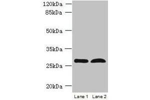 Western blot All lanes: RTP4 antibody at 5 μg/mL Lane 1: K562 whole cell lysate Lane 2: Mouse thymus tissue Secondary Goat polyclonal to rabbit IgG at 1/10000 dilution Predicted band size: 28 kDa Observed band size: 28 kDa (RTP4 antibody  (AA 1-224))