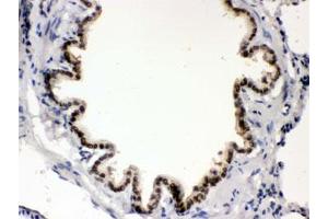 IHC testing of FFPE rat lung with BMP5 antibody. (BMP5 antibody)