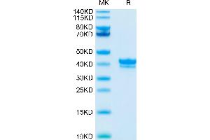 Cynomolgus BCMA on Tris-Bis PAGE under reduced condition. (BCMA Protein (AA 1-53) (Fc Tag))