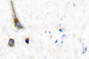 Image no. 1 for anti-Potassium Voltage-Gated Channel, Shaw-Related Subfamily, Member 2 (KCNC2) antibody (ABIN271788) (KCNC2 antibody)