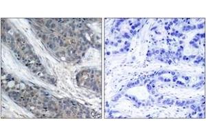Immunohistochemistry (IHC) image for anti-Insulin Receptor Substrate 1 (IRS1) (pSer307) antibody (ABIN2888447) (IRS1 antibody  (pSer307))