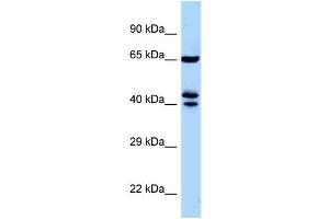 WB Suggested Anti-Zfp583 Antibody Titration: 1. (ZNF583 antibody  (Middle Region))