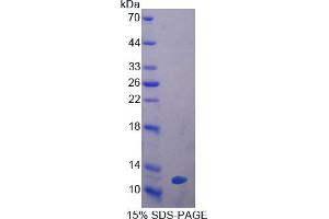 Image no. 1 for Glutathione Peroxidase 3 (Plasma) (GPX3) (AA 3-72) protein (His tag) (ABIN4989663)