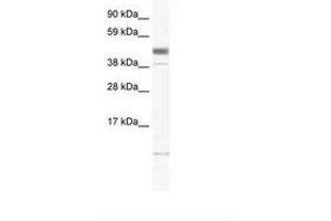 Image no. 1 for anti-Zinc Finger, Matrin-Type 1 (ZMAT1) (AA 359-408) antibody (ABIN6736003) (ZMAT1 antibody  (AA 359-408))