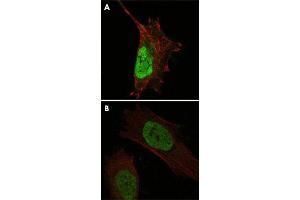 Confocal immunofluorescence analysis of cells using MDM4 monoclonal antobody, clone 2D10F4  (green).