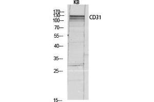 Western Blotting (WB) image for anti-Platelet/endothelial Cell Adhesion Molecule (PECAM1) (Thr224) antibody (ABIN3183761)