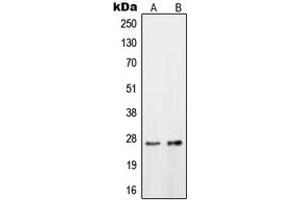 Western blot analysis of OTUB2 expression in HeLa (A), HepG2 (B) whole cell lysates.