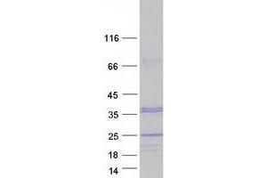 Western Blotting (WB) image for Charged Multivesicular Body Protein 1A (CHMP1A) (Transcript Variant 2) protein (Myc-DYKDDDDK Tag) (ABIN2713980)