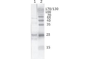 Western Blot testing of HIV-1 recombinant Tat protein. (HIV-1 Tat antibody  (AA 71-81))