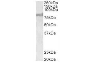Western Blotting (WB) image for anti-ATP-Binding Cassette, Sub-Family D (ALD), Member 2 (Abcd2) (AA 460-473), (Internal Region) antibody (ABIN1105183) (Abcd2 antibody  (Internal Region))