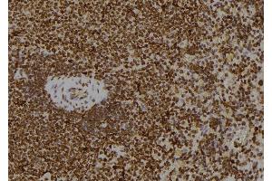 ABIN6268644 at 1/100 staining Rat spleen tissue by IHC-P. (JAK1 antibody)