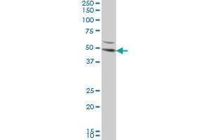 DKK1 monoclonal antibody (M08), clone 2B12 Western Blot analysis of DKK1 expression in HeLa . (DKK1 antibody  (AA 1-266))