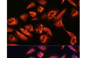 Immunofluorescence analysis of U2OS cells using DPP4 Polyclonal Antibody at dilution of 1:100. (DPP4 antibody)