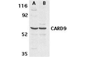 Western blot analysis of CARD9 expression in human MDA-MB-361 (A) and PC-3 (B) cell lysate with AP30185PU-N CARD9 antibody at 2.