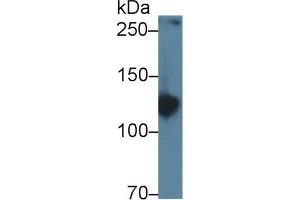 Western Blot; Sample: Rat Serum; Primary Ab: 1µg/ml Rabbit Anti-Rat AMPH Antibody Second Ab: 0. (Amphiphysin antibody  (AA 24-240))