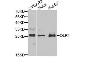 Western blot analysis of extracts of various cell lines, using OLR1 antibody. (OLR1 antibody  (AA 58-273))