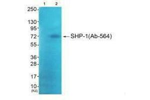 Western blot analysis of extracts from JK cells (Lane 2), using SHP-1 (Ab-564) antiobdy. (MSK1 antibody  (C-Term))