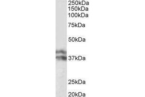 Western Blotting (WB) image for anti-Haptoglobin (HP) (Internal Region) antibody (ABIN2464980)