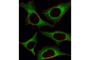 Fluorescent image of Hela cell stained with PI3KCD Antibody . (PIK3CD antibody  (C-Term))