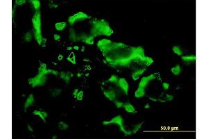 Immunofluorescence (IF) image for anti-Eukaryotic Translation Initiation Factor 4E Family Member 2 (EIF4E2) (AA 1-245) antibody (ABIN564092)