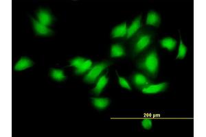 Immunofluorescence of monoclonal antibody to CAMK2A on HeLa cell. (CAMK2A antibody  (AA 305-410))