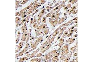 Immunohistochemical analysis of MAPKAPK3 staining in human heart formalin fixed paraffin embedded tissue section. (MAPKAP Kinase 3 antibody  (C-Term))