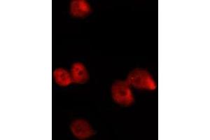 ABIN6277192 staining HepG2 by IF/ICC. (Histone 3 antibody  (H3K4me))