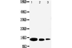 Anti-MIG antibody, Western blotting Lane 1: Recombinant Human CXCL9 Protein 10ng Lane 2: Recombinant Human CXCL9 Protein 5ng Lane 3: Recombinant Human CXCL9 Protein 2. (CXCL9 antibody  (N-Term))