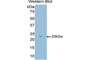 Detection of Recombinant FBLN1, Mouse using Polyclonal Antibody to Fibulin 1 (FBLN1) (Fibulin 1 antibody  (AA 399-578))
