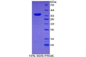 SDS-PAGE analysis of Rat Myosin ID Protein.