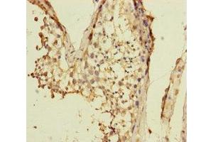 Immunohistochemistry of paraffin-embedded human testis tissue using ABIN7175313 at dilution of 1:100 (VPS33B antibody  (AA 348-617))