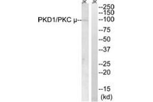 Western blot analysis of extracts from Jurkat cells, using PKD1/PKC mu (Ab-910) Antibody. (PKC mu antibody  (AA 863-912))
