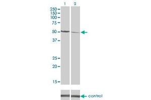 Western blot analysis of CAMK2D over-expressed 293 cell line, cotransfected with CAMK2D Validated Chimera RNAi (Lane 2) or non-transfected control (Lane 1). (CAMK2D antibody  (AA 301-410))