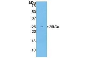 Western blot analysis of recombinant Human NOS1. (NOS1 antibody  (AA 1199-1399))