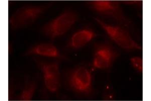 Image no. 1 for anti-Ribosomal Protein S6 Kinase, 70kDa, Polypeptide 1 (RPS6KB1) (Thr389) antibody (ABIN197396)