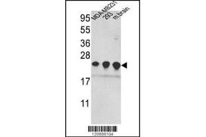 Western blot analysis of PRDX2 Antibody in MDA-MB231,293 cell line and mouse brain tissue lysates (35ug/lane)(2ug/ml) (Peroxiredoxin 2 antibody  (C-Term))