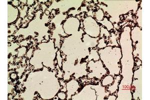 Immunohistochemistry (IHC) analysis of paraffin-embedded Rat Lung, antibody was diluted at 1:100. (NRF2 antibody  (acLys599))