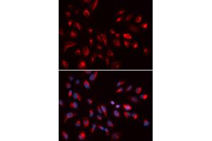 Immunofluorescence analysis of U2OS cells using CHRM5 antibody (ABIN5973103). (CHRM5 antibody)