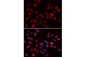 Immunofluorescence analysis of U2OS cells using CHRM5 antibody (ABIN5973103). (CHRM5 antibody)