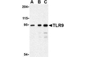 Western blot analysis of TLR9 in Jurkat cell lysate with this product at (A) 0. (TLR9 antibody  (Center))
