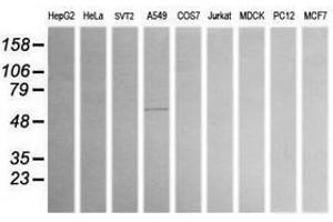 Image no. 1 for anti-Aldehyde Dehydrogenase 1 Family, Member A3 (ALDH1A3) (AA 1-100), (AA 413-512) antibody (ABIN1490536) (ALDH1A3 antibody  (AA 1-100, AA 413-512))